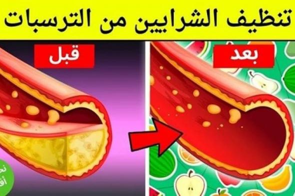 استخدم هذا العشبه الجبارة لتنظيف الشرايين من الدهون المتراكمة حتي لو كانت منذ سنوات؟!