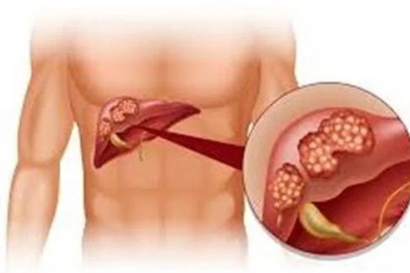 احذر وبشدة.. ألم القدم مؤشر للإصابة بمرض خطير لن تتوقعه