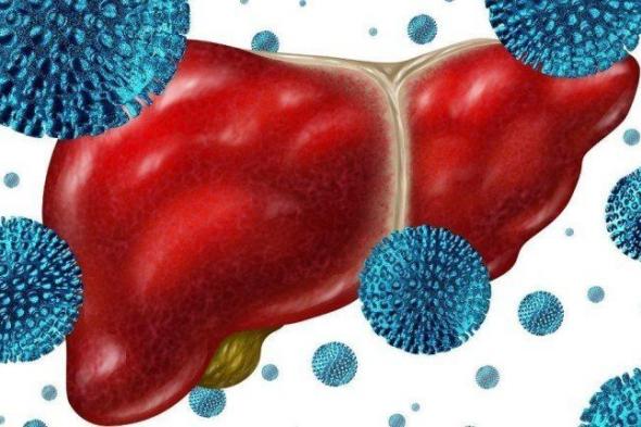 تقنية مبتكرة لتحديد نوع أورام الكبد باستخدام الذكاء الاصطناعي